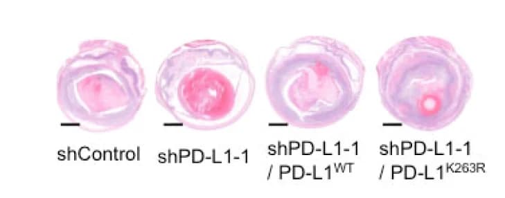 Open access visualization of Microscopy, H&E Staining, UM Orthotopic Xenografts, Tumor Cells