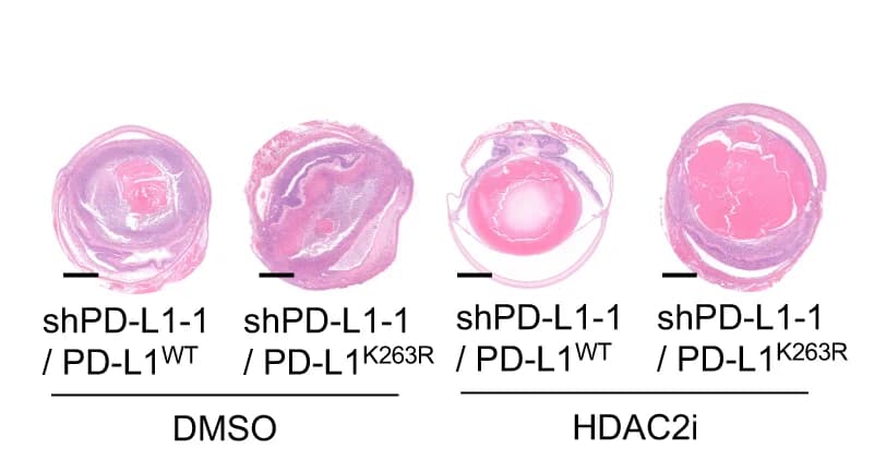 Open access visualization of Microscopy, H&E Staining, UM Orthotopic Xenografts, Tumor Cells, HDAC2i
