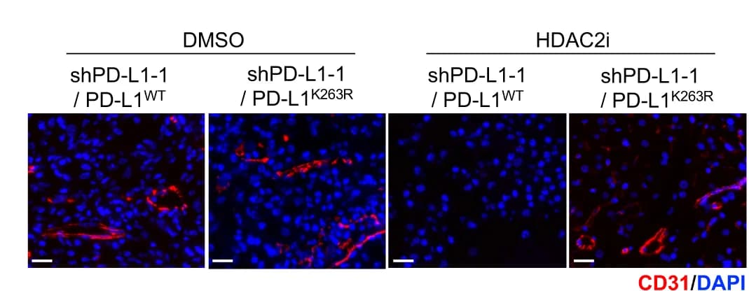 Open access visualization of Microscopy, IF Images, CD31, UM Orthotopic Xenografts, Tumor Cells