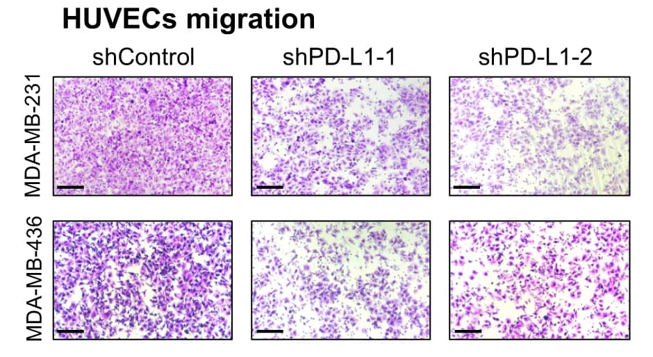 Open access visualization of Microscopy, HUVECs, Migration Assay, Conditional Medium, PD-L1 Silenced Breast Cancer Cells