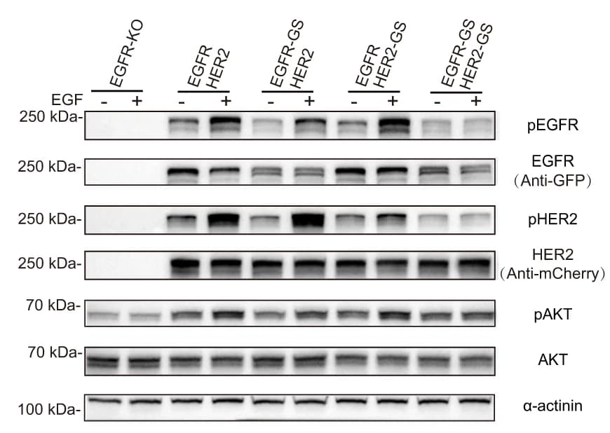 Open access visualization of Gel, Phosphorylation, EGFR, HER2, AKT