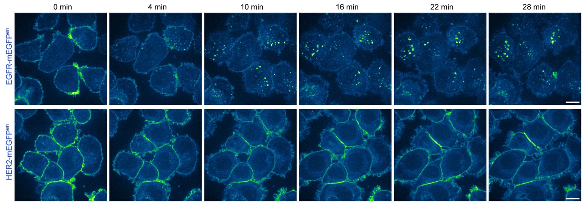 Open access visualization of Microscopy, SK-BR-3 Cells, Genome-edited Cells, EGFR-mEGFP, HER2-mEGFP