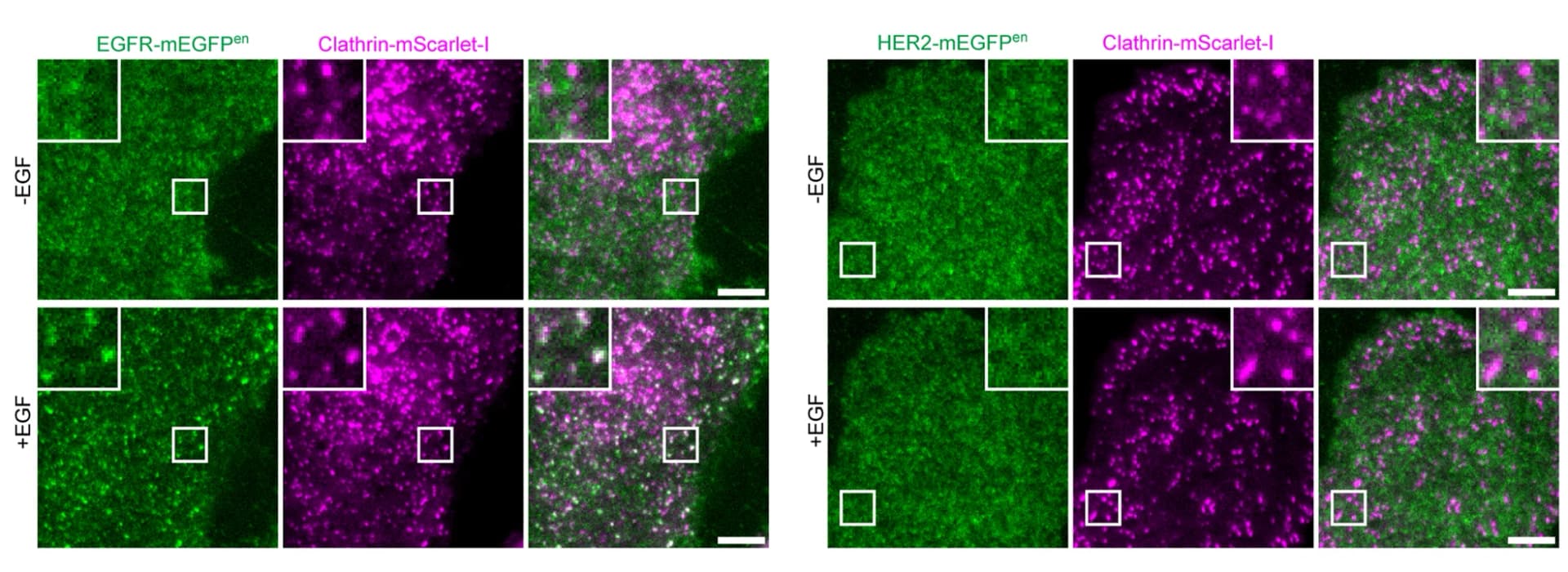 Open access visualization of Microscopy, SK-BR-3 Cells, Genome-edited Cells, EGFR-mEGFP, HER2-mEGFP