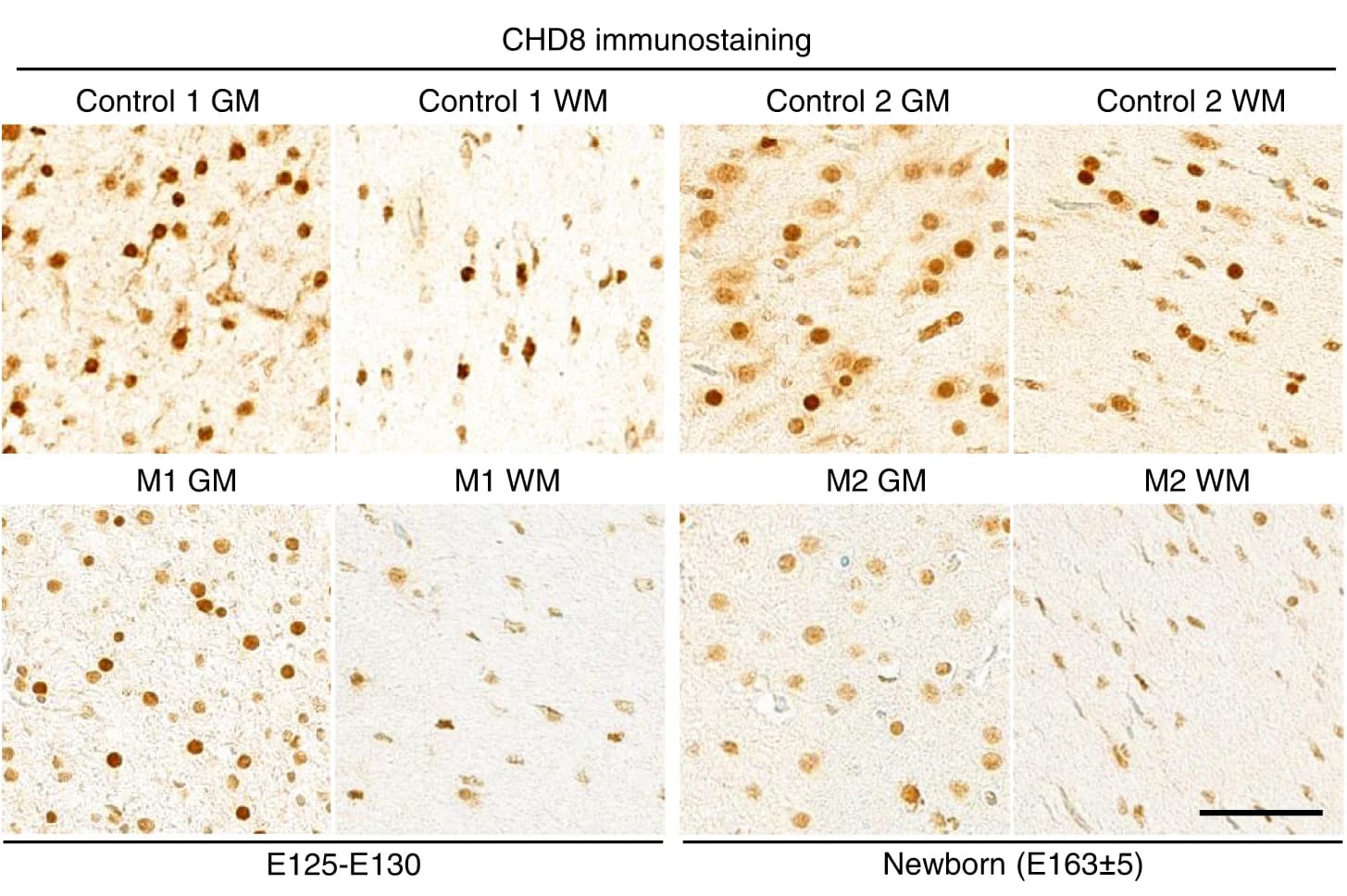Open access visualization of Microscopy, Immunostaining, Prefrontal Cortex, Gray Matter, White Matter