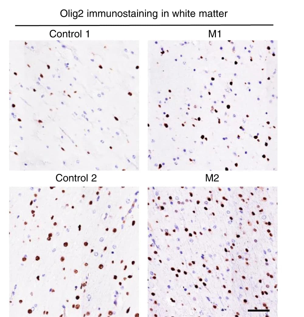 Open access visualization of Microscopy, Immunostaining, White Matter, Control Monkeys, CHD8 Mutant Monkeys