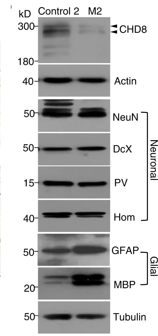 Open access visualization of Gel, Oligodendrocyte Density, White Matter, Control Monkeys, CHD8 Mutant Monkeys