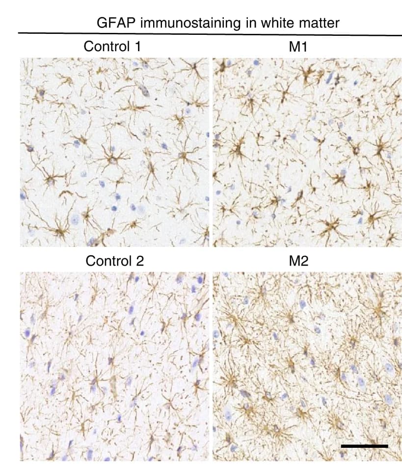 Open access visualization of Microscopy, GFAP Immunostaining, White Matter, Control, CHD8 Mutant Monkeys