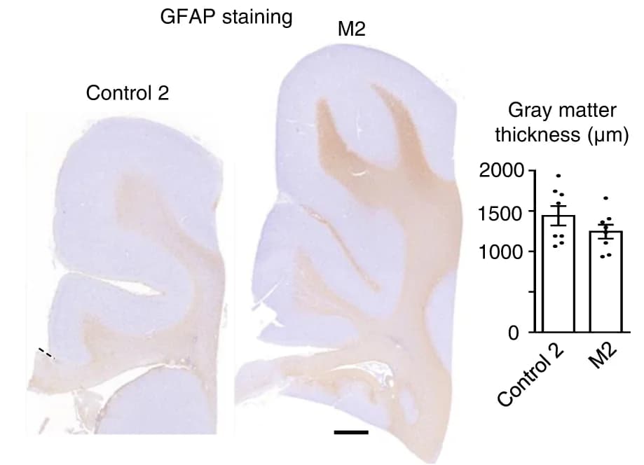 Open access visualization of Microscopy, Bar Plot, Error Bars, GFAP Positive Cells, GFAP Immunostaining