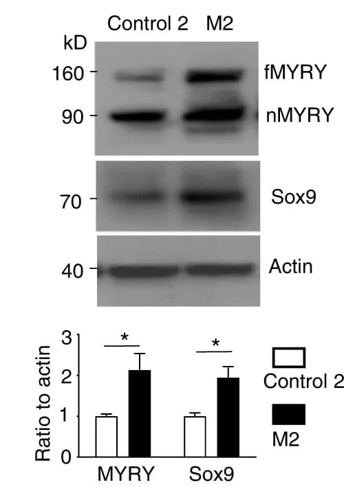 Open access visualization of Gel, Bar Plot, Error Bars, Western Blotting, MYRF
