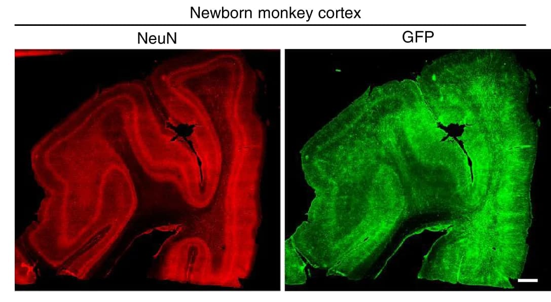 Open access visualization of Microscopy, GFP, Lentivirus, CHD8, gRNA/Cas9