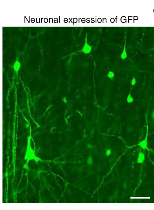 Open access visualization of Microscopy, Neuronal Expression, GFP, Newborn Monkey Brain, Cortex