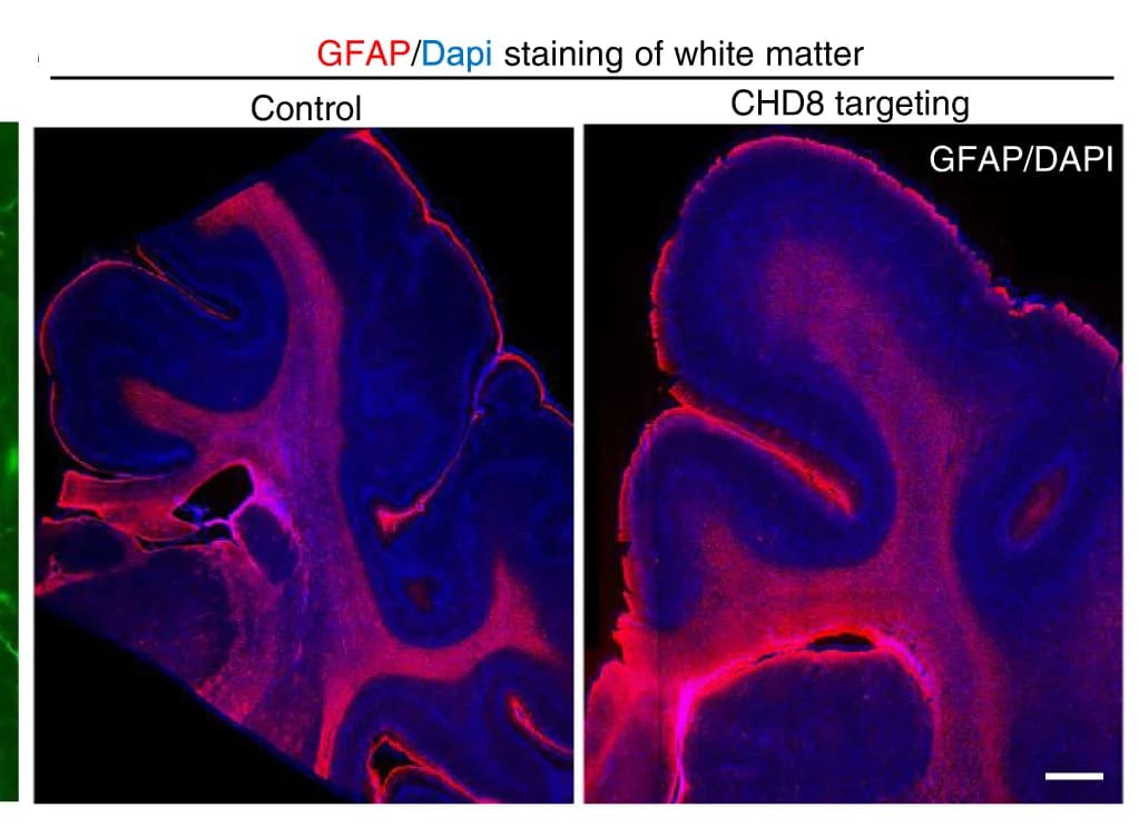 Open access visualization of Microscopy, GFAP, White Matter, Brain Cortical Region, Control