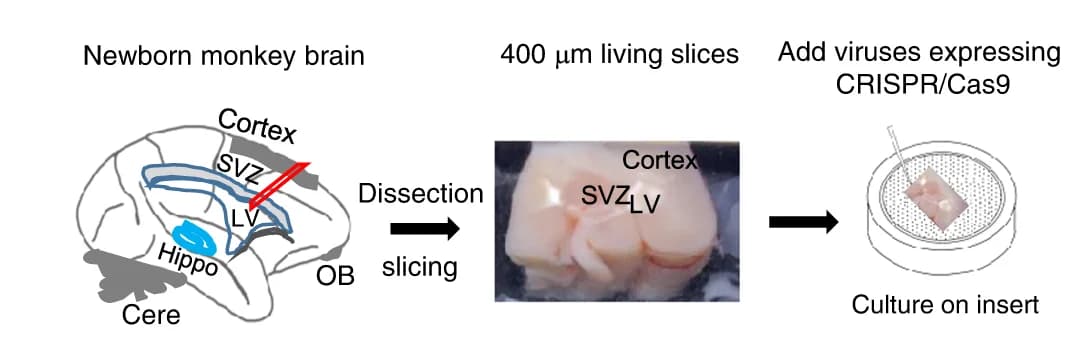 Open access visualization of Workflow, Illustration, Photo, Brain Region, Brain Slice Culture