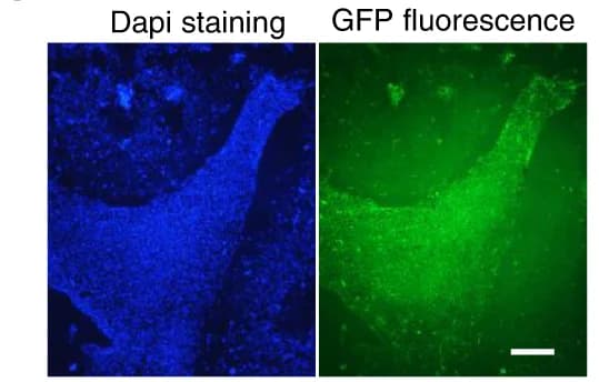 Open access visualization of Microscopy, Photo, Lentivirus, Brain Slices, GFP Signaling