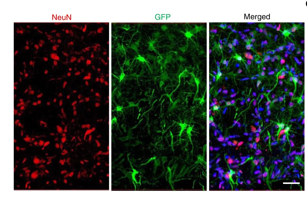 Open access visualization of Microscopy, Immunostaining, Brain Slices, GFP-positive Cells, NeuN