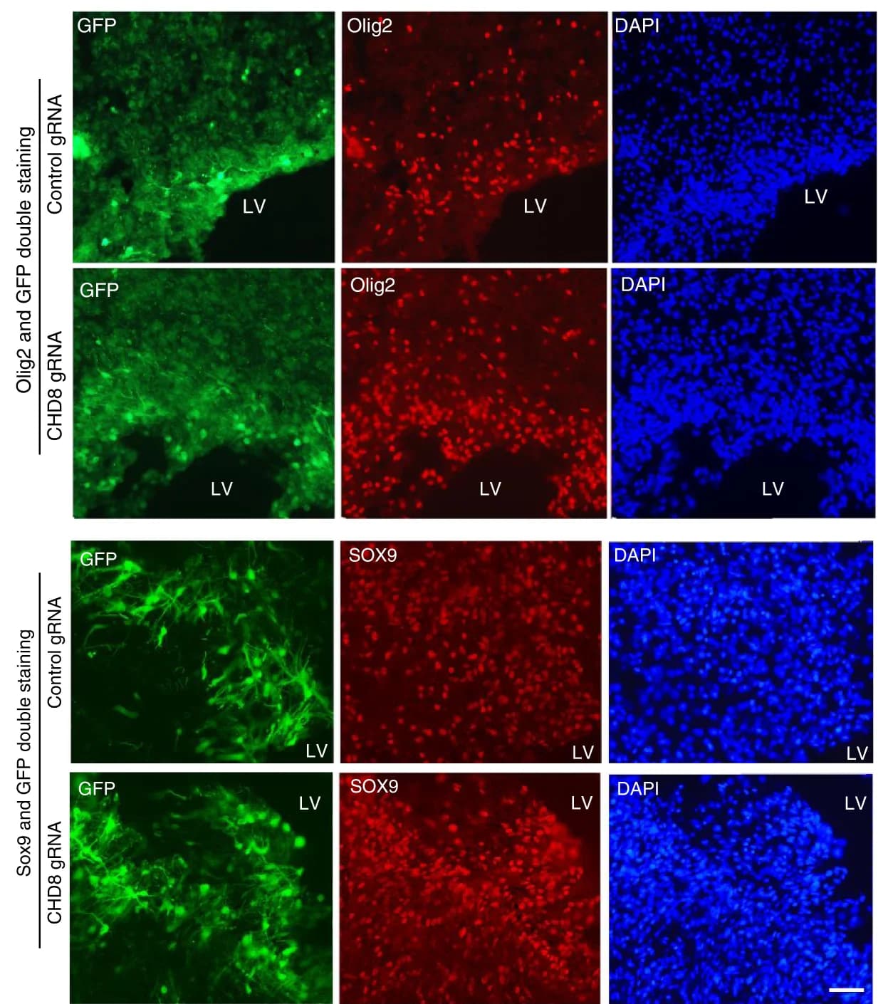 Open access visualization of Microscopy, Double Immunostaining, Brain Slice, Olig2-labeled Oligodendrocytes, SOX9-labeled Astrocytes