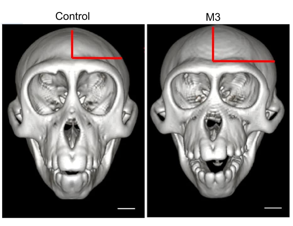 Open access visualization of Microscopy, Skeleton head images, Monkey, Scale bar