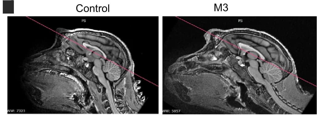Open access visualization of Microscopy, Sagittal MRI images, Cerebral cortex, Monkey
