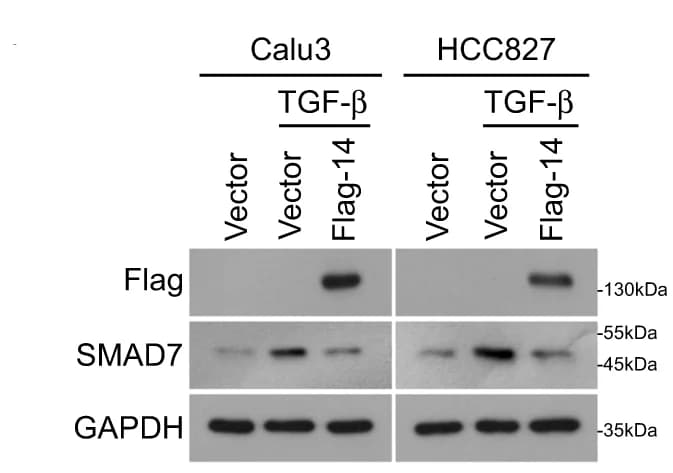 Open access visualization of Gel, WB analysis, PHF14, SMAD7, LAD cells
