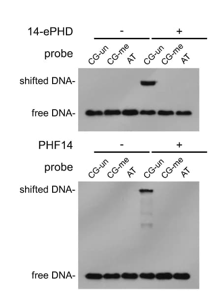 Open access visualization of Gel, PHF14 ePHD Domain, PHF14 Protein, Oligonucleotides Probes, EMSA