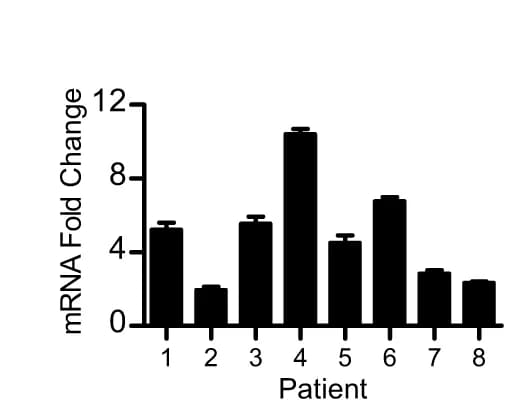 Open access visualization of Bar Plot, Error Bars, WB, qPCR, PHF14 Expression