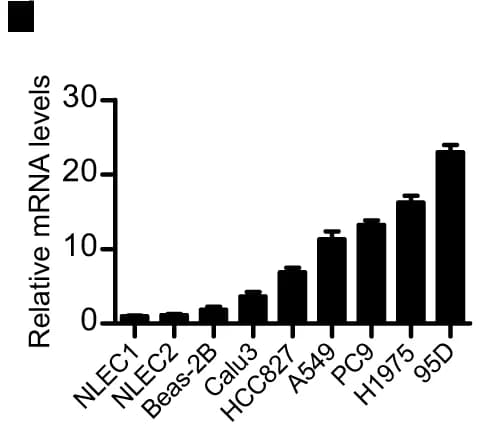 Open access visualization of Bar Plot, Error Bars, WB, qPCR, PHF14 Expression