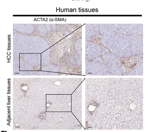 Open access visualization of Microscopy, SMA Expression, HCC, Normal Tissues, IHC Experiments