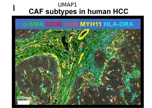 Open access visualization of Microscopy, Multiplex Immunofluorescence, CAF Clusters, HCC Tissues