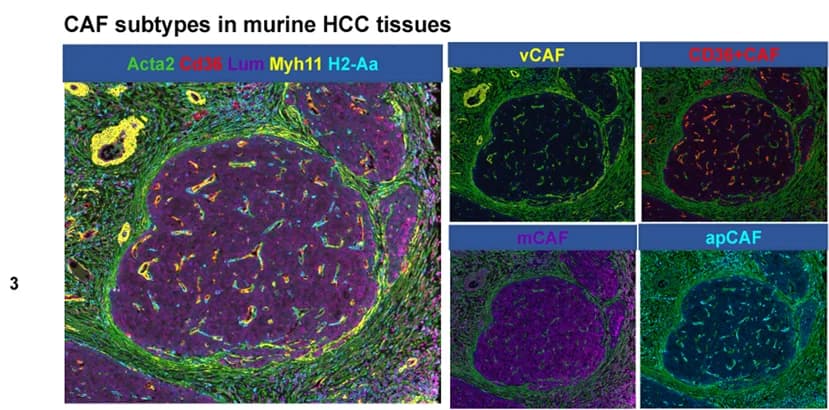 Open access visualization of Microscopy, Multiplex Immunofluorescence, CAF Clusters, Murine, HCC