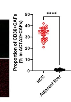 Open access visualization of Scatter Plot, mIF, CD36+ CAFs, Human HCC, Liver Tissues
