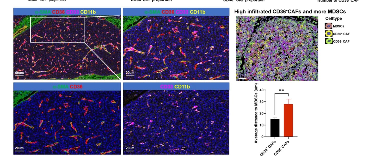 Open access visualization of Microscopy, Bar Plot, Error Bars, MIF Staining, CD36+ CAFs