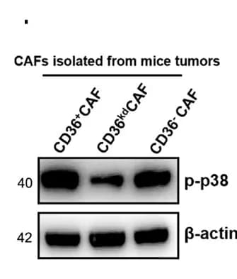 Open access visualization of Gel, p-p38 Expression, CD36 + CAFs, CD36 kd CAFs, CD36 - CAFs