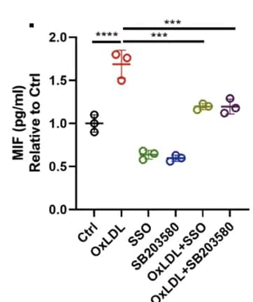 Open access visualization of Bar Plot, Error Bars, CD36 + CAFs, OxLDL, SSO