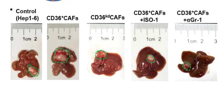 Open access visualization of Photo, HCC Tumors, HCC Model