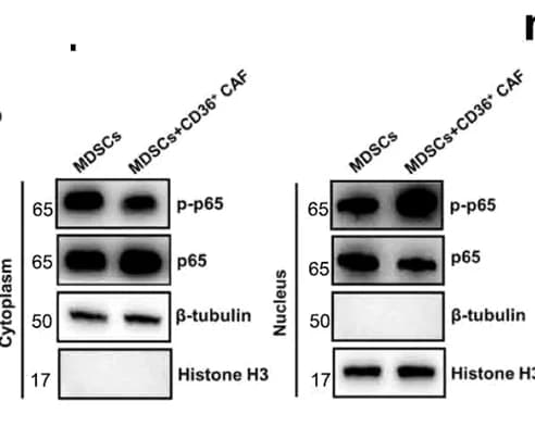 Open access visualization of Gel, Western Blotting, NF-kB Pathway, MDSCs, CD36+ CAFs