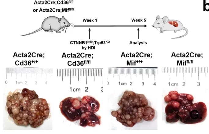 Open access visualization of Illustration, Workflow, Photo, HCC Initiation, HCC Progression