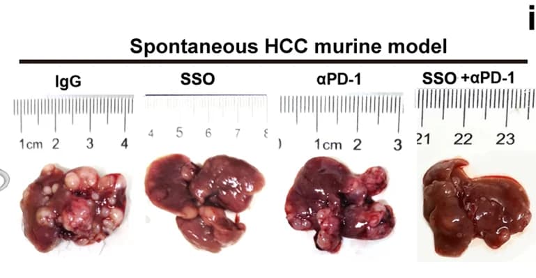 Open access visualization of Photo, CD36 Inhibitor, SSO, PD-1 Blockade, C57/BJ6 Spontaneous HCC Model