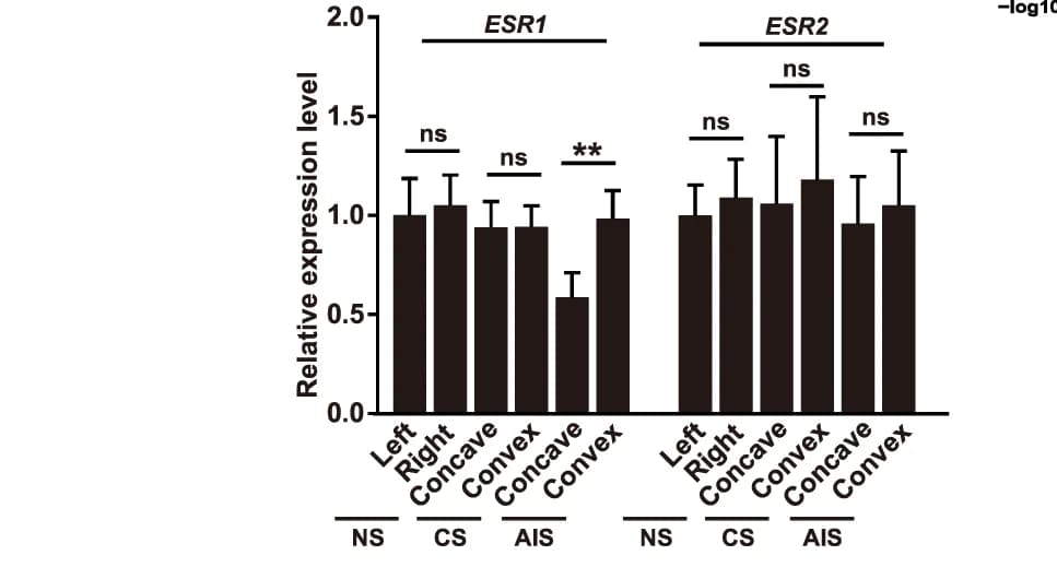 Open access visualization of Bar Plot, Error Bars, RT-qPCR, ESR1, ESR2