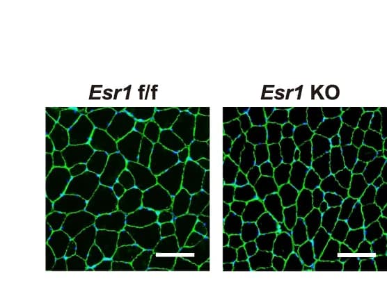 Open access visualization of Microscopy, Immunofluorescent Staining, Muscle, Laminin, DAPI