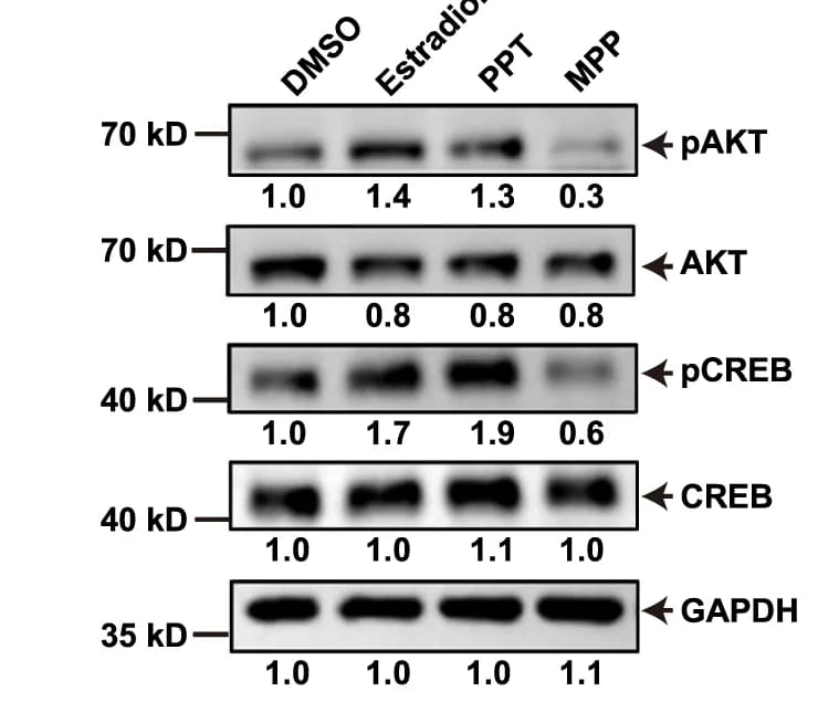 Open access visualization of Gel, Immunoblotting, Phosphorylated AKT, Total AKT, Phosphorylated CREB