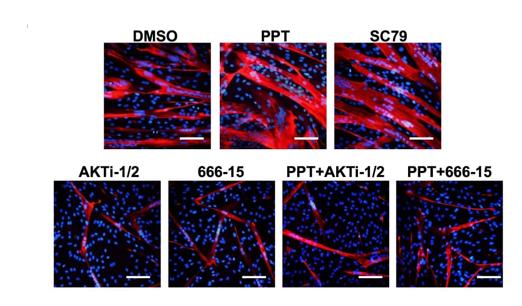 Open access visualization of Microscopy, Immunofluorescent Staining, MyHC, Muscle Stem/Progenitor Cells, DMSO