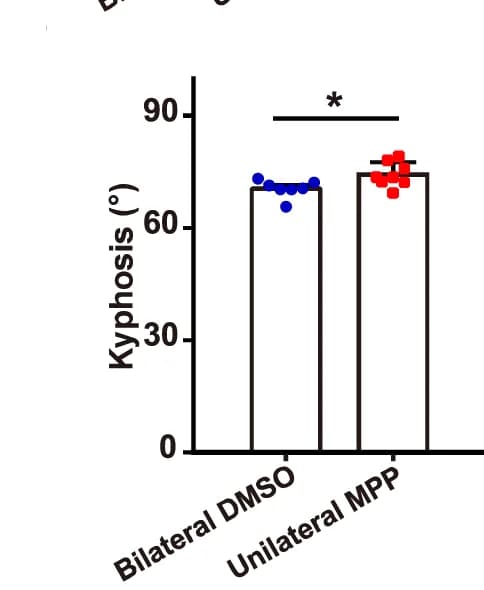 Open access visualization of Bar Plot, Statistical Analysis, Kyphosis, Sagittal Plane, DMSO