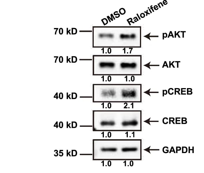Open access visualization of Gel, Immunoblotting, AKT, Phosphorylated AKT, CREB