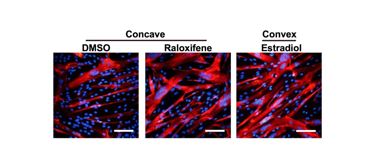 Open access visualization of Microscopy, Immunofluorescent Staining, Muscle Stem/Progenitor Cells, Raloxifene, AIS Patients