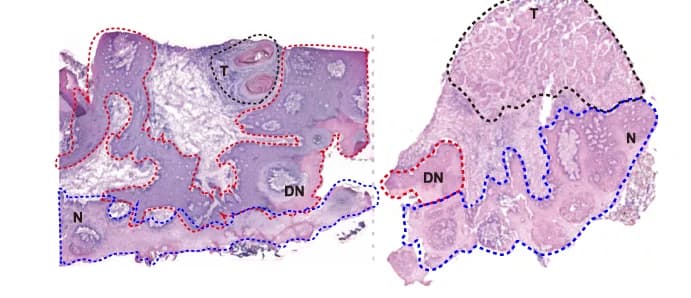 Open access visualization of Microscopy, H&E Images, ST Samples, Initiation Stages, Clinical Pathologist