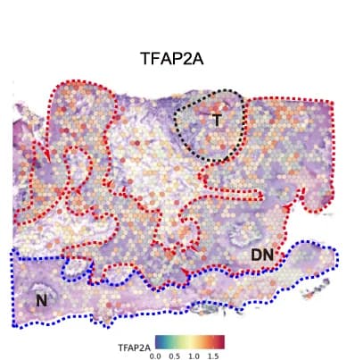 Open access visualization of Microscopy, Spatial Feature Plots, TFAP2A, Tissue Sections