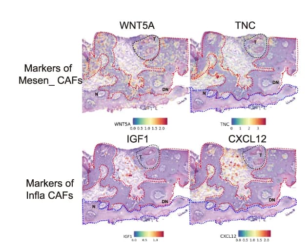 Open access visualization of Microscopy, Spatial Feature Plots, Mesen CAFs, WNT5A, TNC