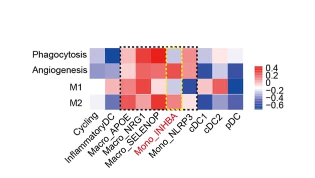 Open access visualization of Heatmap, Pathway Enrichment, M1 Macrophages, M2 Macrophages, Angiogenesis