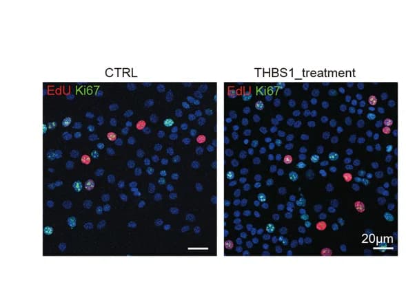Open access visualization of Microscopy, EdU Staining, Ki67 Staining, OLK Organoids, THBS1 Treatment