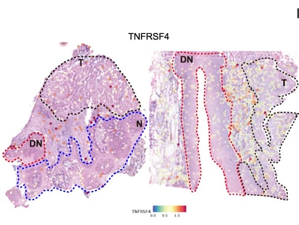 Open access visualization of Microscopy, ST Feature Plots, TNFRSF4, P1, P2